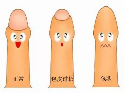 割包皮,根据我亲身经历,这很正常。。