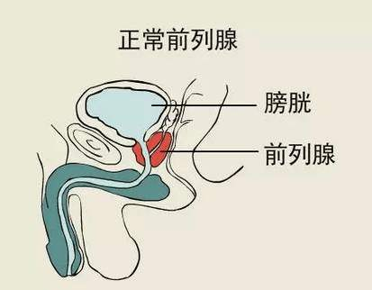 前列腺增生手术,前列腺增生手术费用,前列腺增生手术贵吗?