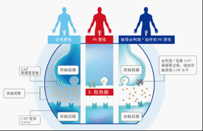 早泄治疗,早泄原因,早泄症状,早泄药物,早泄危害