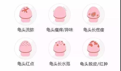龟头炎图片,龟头炎症状,龟头炎治疗,龟头炎危害,龟头炎图片,龟头炎症状,龟头炎治疗,龟头炎治多钱