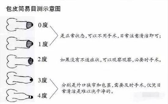 包皮包茎图片,包皮包茎区别,包皮包茎手术,包皮包茎咨询