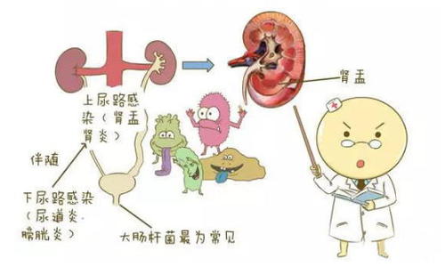 泌尿系统感染危害,泌尿系统感染治疗,泌尿系统感染症状,泌尿系统感染危害,