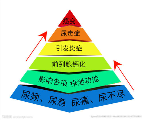 前列腺炎症状,前列腺炎用药,前列腺炎治疗,前列腺炎药物