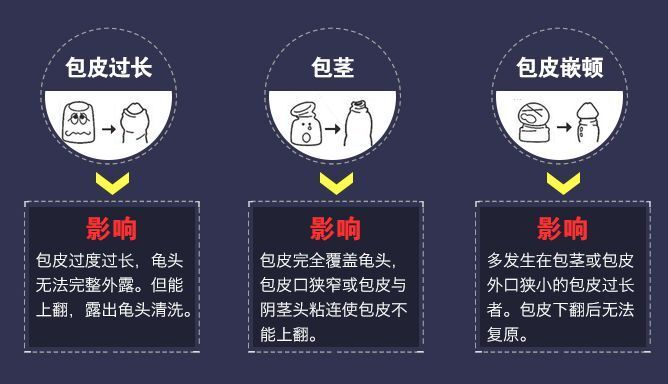 包皮过长危害,包皮过长图片,包皮过长早泄,包皮过长原因